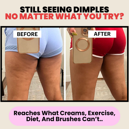 Clinical Cellulite Eraser Complete Kit